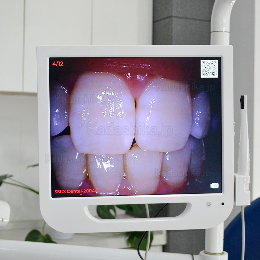 歯科用口腔内カメラ 17インチ液晶モニター付き